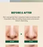 KSECRET SEOUL 1988 Cleansing Foam : Pine Cica 1% + Probiotics