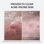Arencia Skin Clarifying Booster Shot Trio 2pcs Bundle Set
